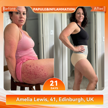 𝐎𝐟𝐟𝐢𝐜𝐢𝐚𝐥 𝐁𝐫𝐚𝐧𝐝 𝐒𝐭𝐨𝐫𝐞 👙 Natravor® 𝟐𝟎𝟐𝟔 𝐌𝐨𝐫𝐢𝐧𝐠𝐚 & 𝐁𝐞𝐫𝐛𝐞𝐫𝐢𝐧𝐞 𝟒-𝐈𝐧-𝟏 𝐌𝐢𝐜𝐫𝐨-𝐏𝐚𝐫𝐭𝐢𝐜𝐥𝐞 𝐒𝐜𝐮𝐥𝐩𝐭𝐢𝐧𝐠 & 𝐅𝐚𝐭-𝐁𝐮𝐫𝐧 𝐒𝐡𝐨𝐫𝐭𝐬