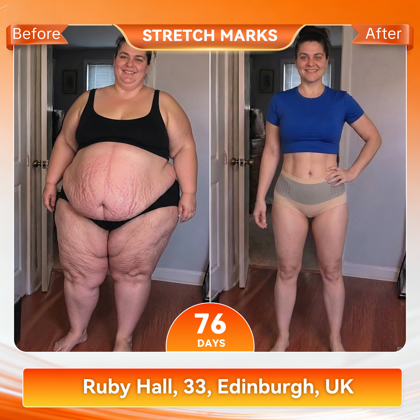 𝐎𝐟𝐟𝐢𝐜𝐢𝐚𝐥 𝐁𝐫𝐚𝐧𝐝 𝐒𝐭𝐨𝐫𝐞 👙 Natravor® 𝟐𝟎𝟐𝟔 𝐌𝐨𝐫𝐢𝐧𝐠𝐚 & 𝐁𝐞𝐫𝐛𝐞𝐫𝐢𝐧𝐞 𝟒-𝐈𝐧-𝟏 𝐌𝐢𝐜𝐫𝐨-𝐏𝐚𝐫𝐭𝐢𝐜𝐥𝐞 𝐒𝐜𝐮𝐥𝐩𝐭𝐢𝐧𝐠 & 𝐅𝐚𝐭-𝐁𝐮𝐫𝐧 𝐒𝐡𝐨𝐫𝐭𝐬