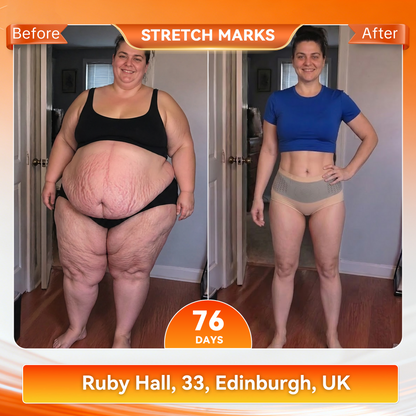 𝐎𝐟𝐟𝐢𝐜𝐢𝐚𝐥 𝐁𝐫𝐚𝐧𝐝 𝐒𝐭𝐨𝐫𝐞 👙 Natravor® 𝟐𝟎𝟐𝟔 𝐌𝐨𝐫𝐢𝐧𝐠𝐚 & 𝐁𝐞𝐫𝐛𝐞𝐫𝐢𝐧𝐞 𝟒-𝐈𝐧-𝟏 𝐌𝐢𝐜𝐫𝐨-𝐏𝐚𝐫𝐭𝐢𝐜𝐥𝐞 𝐒𝐜𝐮𝐥𝐩𝐭𝐢𝐧𝐠 & 𝐅𝐚𝐭-𝐁𝐮𝐫𝐧 𝐒𝐡𝐨𝐫𝐭𝐬